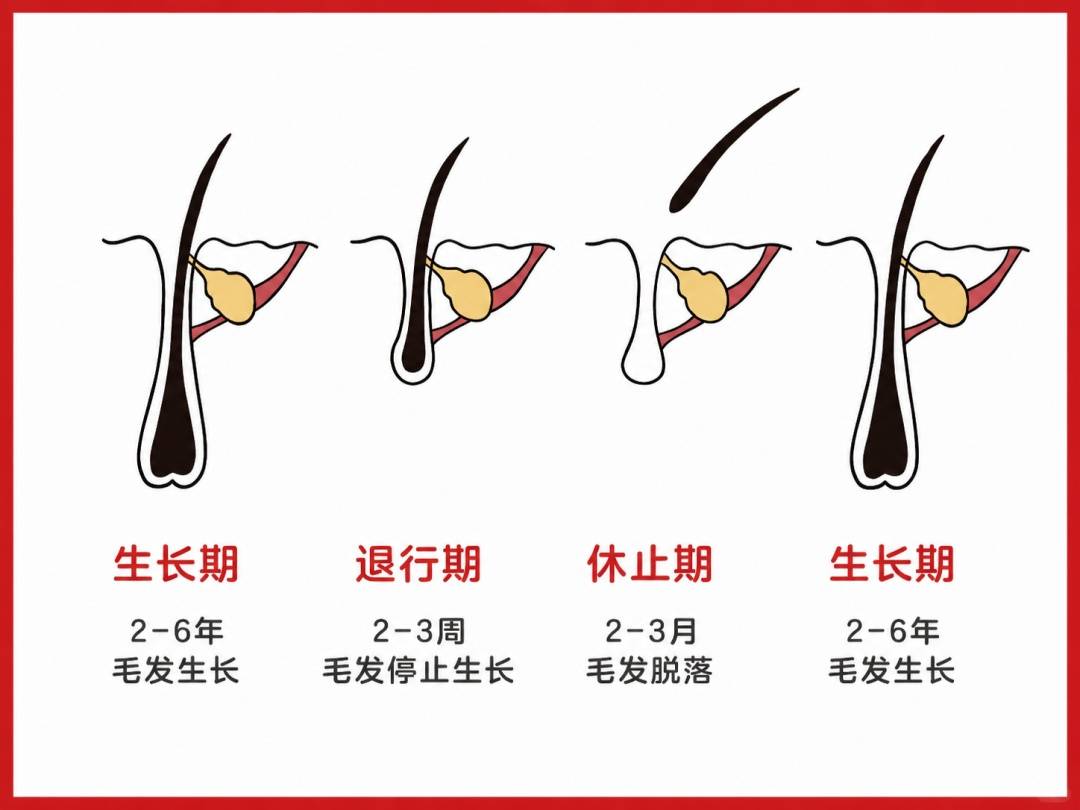 掉头发≠脱发！真正危险的是这几个信号→